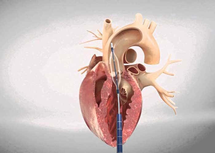 Old Age Cardiac Health