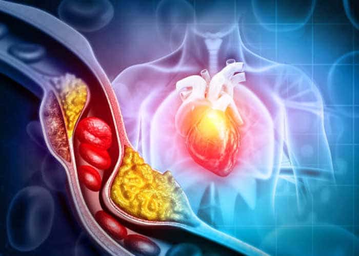 Old Age Cardiac Health