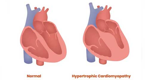 Best Heart Doctor in Hyderabad